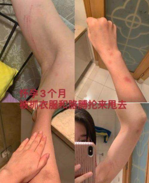 1638091065352002600.jpg 555.jpg